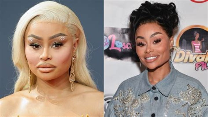 Blac Chyna Removes 'Demonology' Tattoo After Dissolving Facial Filler