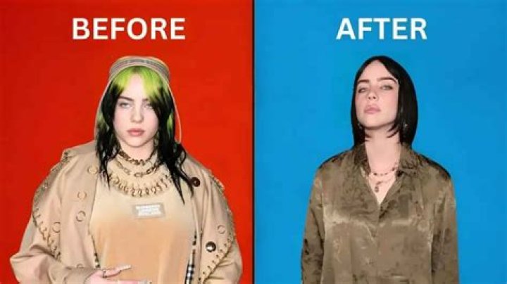 Did Billie Eilish Have Breast Reduction? A Comprehensive Analysis