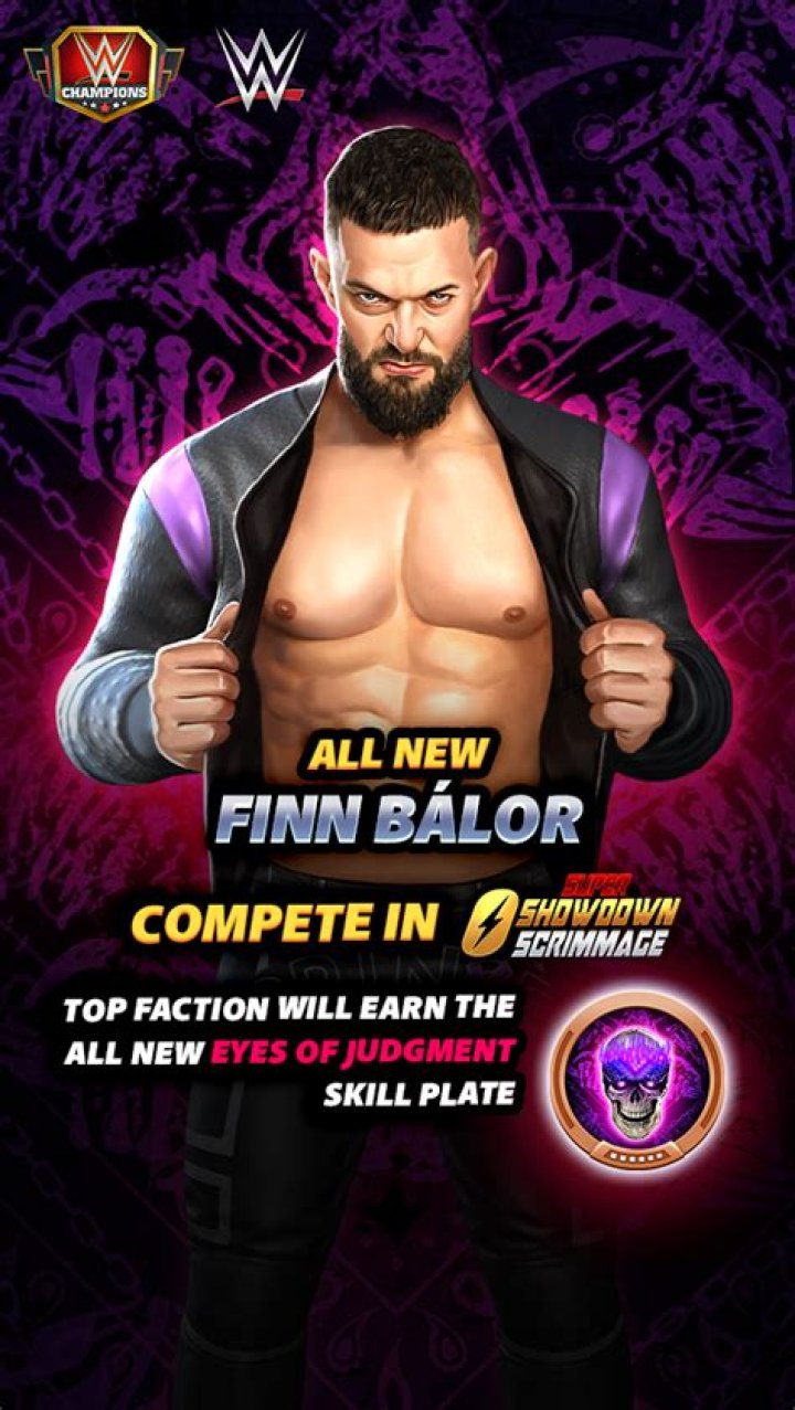 Finn B&aacute;lor's Head and Body Injuries -- Gruesome Pics