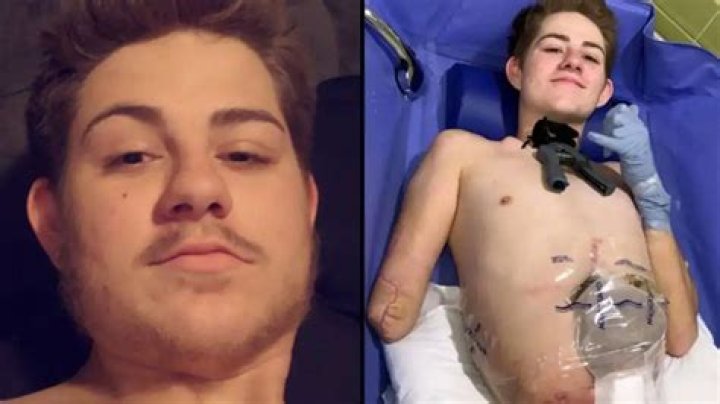 Man chopped in half by forklift bravely goes swimming&hellip;