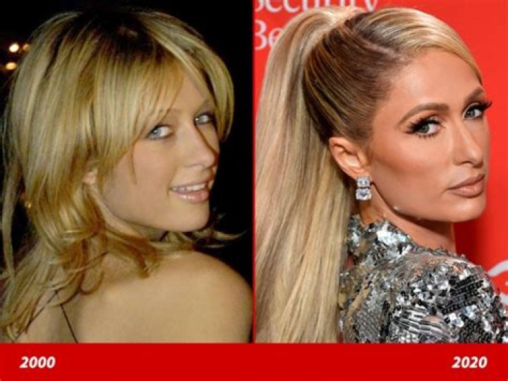 Paris Hilton Good Genes Or Good Docs?!