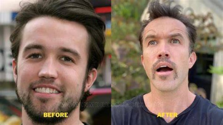 Rob McElhenney Plastic Surgery Fans Suspect Jaw Surgery