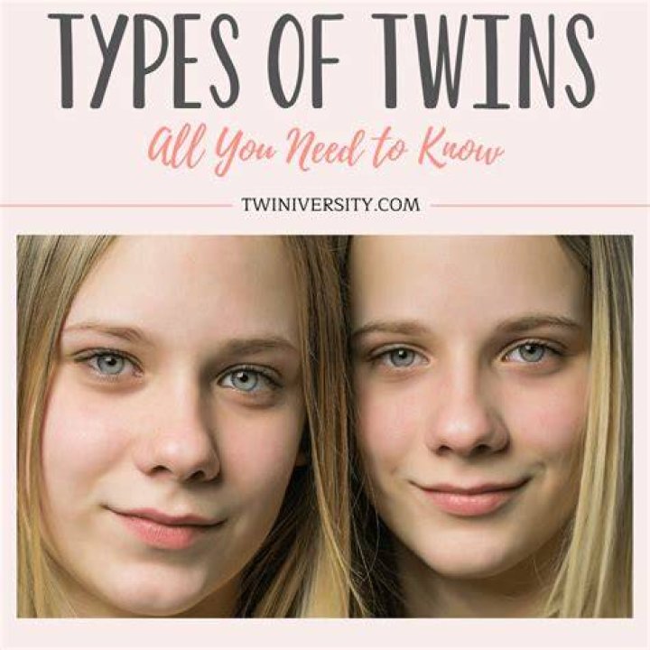 Twins with 'love for plastic surgery and fillers' used to look a lot